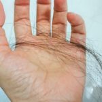 抜け毛・薄毛はミネラル不足