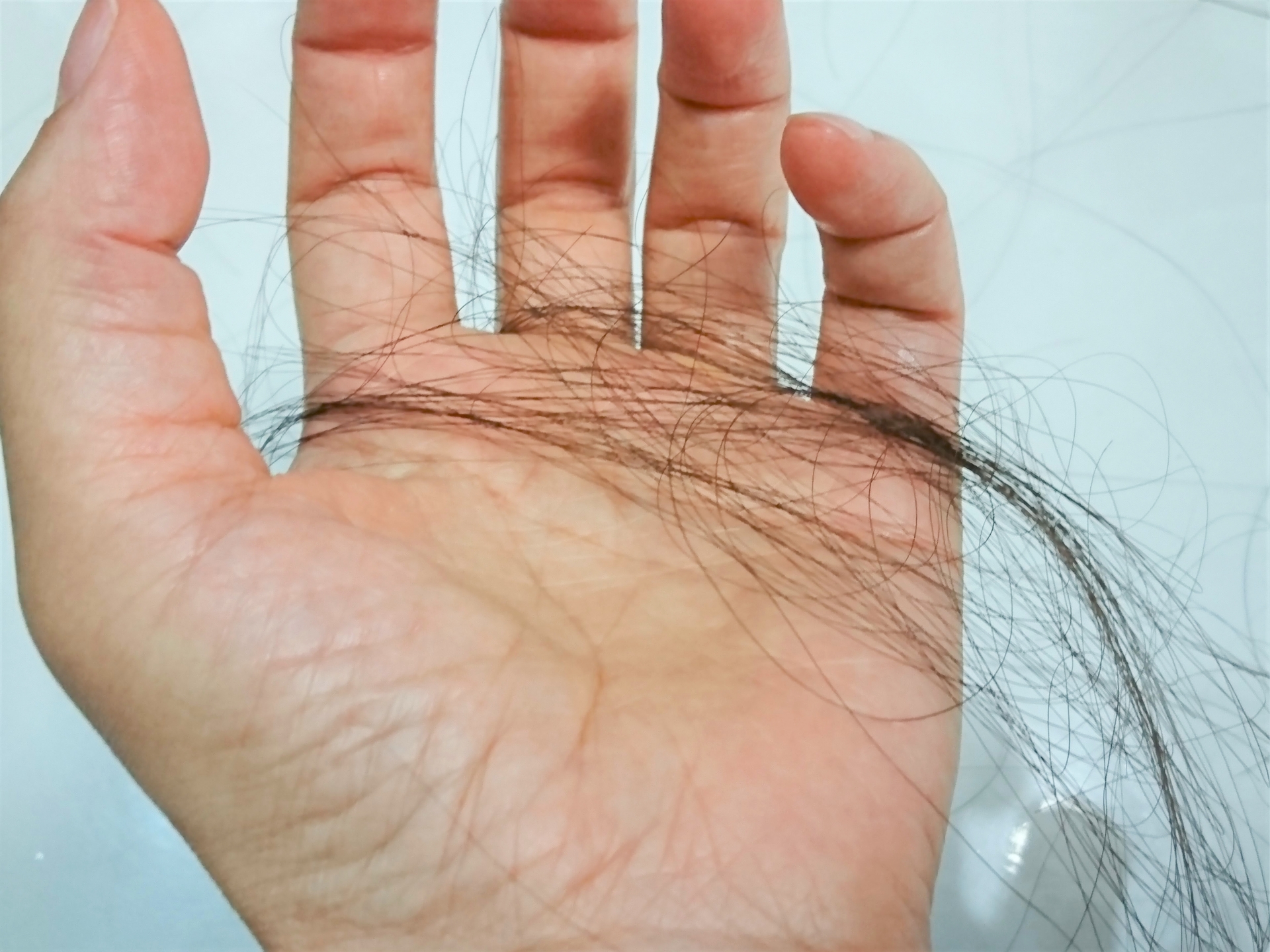 抜け毛・薄毛はミネラル不足